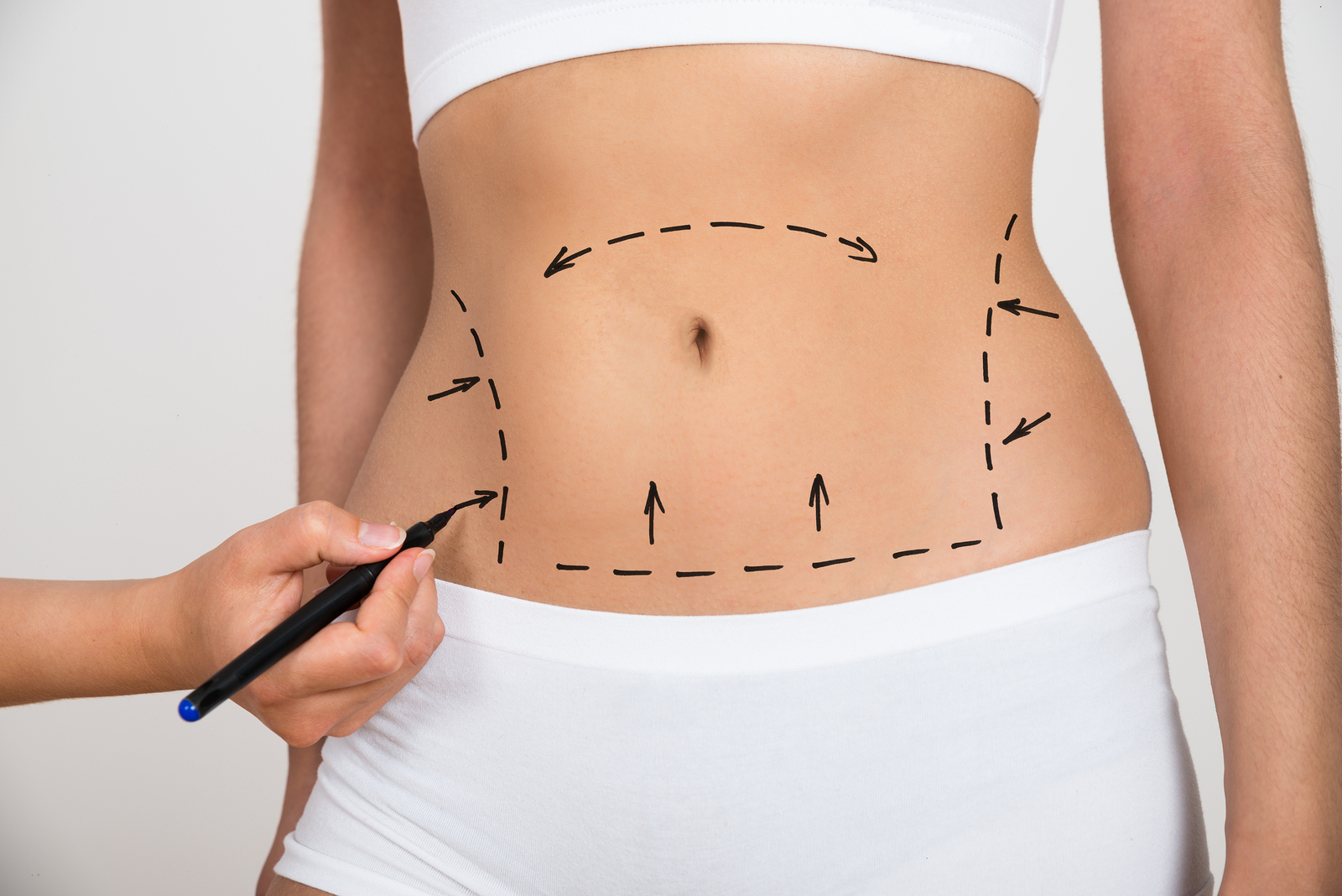 A woman getting a consultation for a tummy tuck near Greensboro, NC