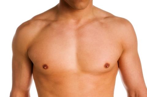 Male Breast Reduction (Gynecomastia Surgery)