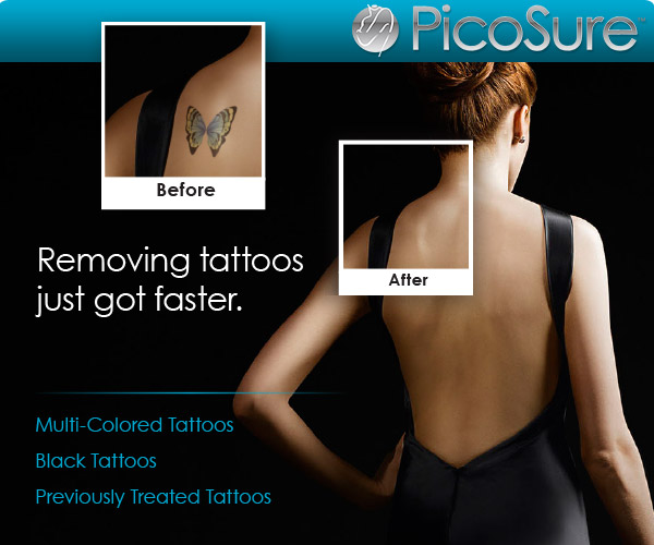 Tattoo Removal Laser | Forsyth Plastic Surgery
